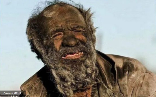 На 94 годишна възраст почина иранецът известен като най мръсния човек в