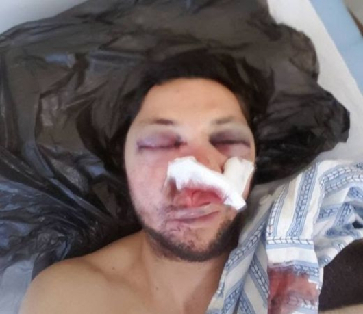 Кадърът показва жестокия побой над Стоян. Снимка Личен фейсбук профил на Стоян Тончев