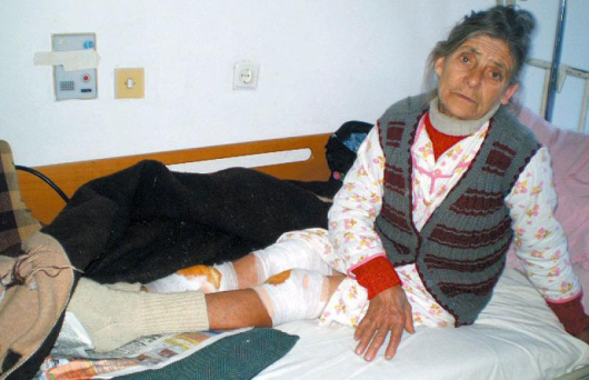 68-годишната Олга Падишанска оцеля, след като беше наръфана от две огромни съседски кучета