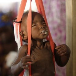 Болно дете в Нигерия на преглед от доктори на организацията ”Лекари без граници”. Сн.: БТА