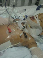 Муса Даиб е със счупени ръце, проблеми с дробовете и е на командно дишане. Сн.: KARE